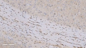 IHC staining of FFPE mouse brain tissue with Aryl hydrocarbon Receptor antibody. HIER: boil tissue sections in pH8 EDTA for 20 min and allow to cool before testing.