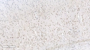 IHC staining of FFPE rat brain tissue with Aryl hydrocarbon Receptor antibody. HIER: boil tissue sections in pH8 EDTA for 20 min and allow to cool before testing.