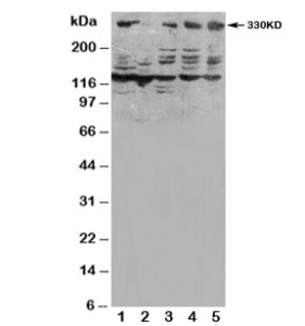 Western blot testing of ATM antibody and Lane 1: HeLa; 2: SMMC-7721; 3: U87; 4: A549; 5: MCF-7