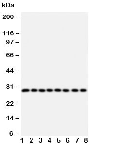 Western blot testing of CISH antibody and Lane 1: rat liver; 2: rat kidney; and human samples 3: placenta; 4: A431; 5: SMMC-7721; 6: HeLa; 7: COLO320; 8: MM231 cell lysate~