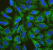 Immunofluorescent staining of FFPE human U-2 OS cells with CISH antibody (green) and DAPI nuclear stain (blue). HIER: steam section in pH6 citrate buffer for 20 min.