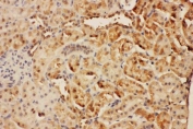 IHC staining of FFPE rat kidney tissue with CISH antibody. HIER: boil tissue sections in pH8 EDTA for 20 min and allow to cool before testing.