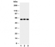 Western blot testing of HEXA antibody and Lane 1:  rat liver;  2: human HeLa;  3: (h) SMMC-7721 cell lysate.  Expected molecular weight: ~60 kDa (precursor), ~54 kDa (mature).