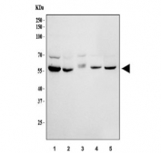 Western blot testing of human 1) HeLa, 2) 293T, 3) Caco-2, 4) ThP-1 and 5) HepG2 cell lysate with HEXA antibody. Expected molecular weight: ~60 kDa (precursor), ~54 kDa (mature).