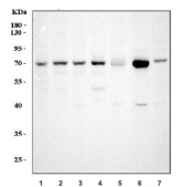 Western blot testing of GRP75 antibody and Lane 1:  rat liver; and human samples  2: A549;  3: 293T;  4: M431;  5: COLO320 cell lysate.  Expected molecular weight: 70~75kDa.