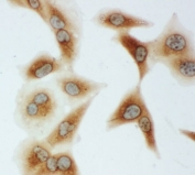 ICC staining of human A549 cells.