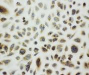 ICC testing of HSP10 antibody and A549 cells