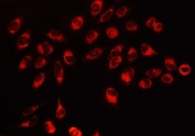 Immunofluorescent staining of FFPE human HeLa cells with HSP10 antibody. HIER: steam section in pH6 citrate buffer for 20 min.