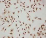 ICC testing of LASP1 antibody and A549 cells
