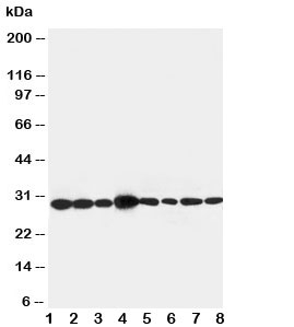 Western blot testing of LASP1 antibody and Lane 1: rat liver ; 2: rat spleen; 3: rat intestine; 4: Jurkat; 5: MCF-7; 6: A431; 7: HeLa; 8: 293T. Expected size: 29KD