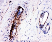 IHC-P: LASP1 antibody testing of human placenta tissue