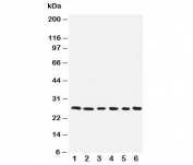 Western blot testing of ARC antibody and human samples 1:  SMMC-7721;  2: A549;  3: U87;  4: HeLa;  5: MCF-7;  6: rat liver