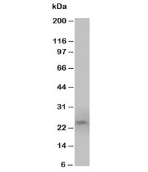 Western blot testing of PrP antibody and U87 cell lysate (human glioma). Expected size: 20~29KD