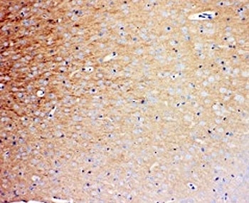 IHC-P: Prion protein antibody testing of rat brain tissue