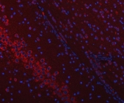 Immunofluorescent staining of FFPE rat brain tissue with SSR3 antibody (red) and DAPI nuclear stain (blue). HIER: steam section in pH6 citrate buffer for 20 min.