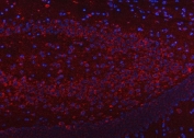 Immunofluorescent staining of FFPE mouse brain tissue with SSR3 antibody (red) and DAPI nuclear stain (blue). HIER: steam section in pH6 citrate buffer for 20 min.