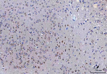 IHC staining of FFPE mouse cerebral cortex tissue with SSR3 antibody. HIER: boil tissue sections in pH8 EDTA for 20 min and allow to cool before testing.
