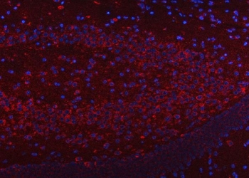Immunofluorescent staining of FFPE mouse brain tissue with SSR3 antibody (red) and DAPI nuclear stain (blue). HIER: steam section in pH6 citrate buffer for 20 min.
