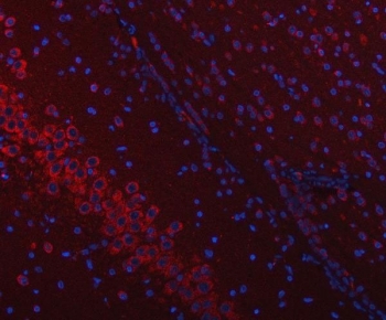Immunofluorescent staining of FFPE rat brain tissue with SSR3 antibody (red) and DAPI nuclear stain (blue). HIER: steam section in pH6 citrate buffer for 20 min.