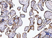 IHC staining of FFPE human placental tissue with SSR3 antibody. HIER: boil tissue sections in pH8 EDTA for 20 min and allow to cool before testing.
