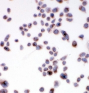ICC staining of FFPE human HeLa cells with SSR3 antibody. HIER: steam section in pH6 citrate buffer for 20 min.
