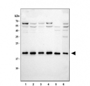 Western blot testing of 1) human HeLa, 2) human HepG2, 3) human K562, 4) monkey COS-7, 5) rat C6 and 6) RAW264.7 cell lysate with SSR3 antibody.  Expected molecular weight ~20 kDa.