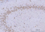 IHC staining of FFPE rat hippocampus tissue with SSR3 antibody. HIER: boil tissue sections in pH8 EDTA for 20 min and allow to cool before testing.