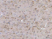 IHC staining of FFPE rat cerebral cortex tissue with SSR3 antibody. HIER: boil tissue sections in pH8 EDTA for 20 min and allow to cool before testing.