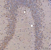 IHC staining of FFPE mouse hippocampus tissue with SSR3 antibody. HIER: boil tissue sections in pH8 EDTA for 20 min and allow to cool before testing.