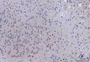 IHC staining of FFPE mouse cerebral cortex tissue with SSR3 antibody. HIER: boil tissue sections in pH8 EDTA for 20 min and allow to cool before testing.