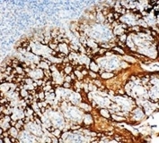 IHC-P: 14-3-3 sigma antibody testing of human tonsil tissue. HIER: boil tissue sections in pH6, 10mM citrate buffer, for 20 min and allow to cool before testing.
