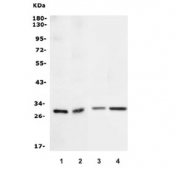 Western blot testing of 1) human HeLa, 2) human PC-3, 3) rat brain and 4) mouse brain lysate with 14-3-3 sigma antibody. Predicted molecular weight: ~28 kDa.