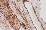 IHC staining of FFPE human placental tissue with TFPI antibody. HIER: boil tissue sections in pH6 citrate buffer for 20 min and allow to cool before testing.
