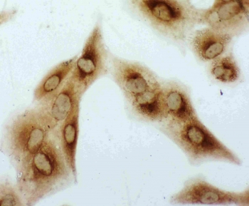 ICC staining of FFPE human A549 cells with HSPB1 antibody. HIER: boil tissue sections in pH6, 10mM citrate buffer, for 10-20 min followed by cooling at RT for 20 min.