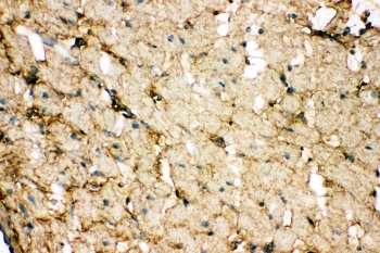 IHC staining of FFPE rat heart with HSPB1 antibody. HIER: boil tissue sections in pH6, 10mM citrate buffer, for 10-20 min followed by cooling at RT for 20 min.