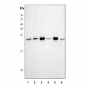 Western blot testing of 1) human U-2 OS, 2) human PC-3, 3) rat H9C2, 4) rat heart, 5) mouse C2C12 and 6) mouse heart tissue lysate with HSPB2 antibody. Predicted molecular weight ~20 kDa.
