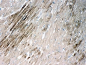 IHC-F testing of HSPB2 antibody and rat heart tissue.