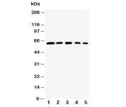 Western blot testing of RelB antibody and Lane 1:  rat testis;  2: (h) HeLa;  3: (m) NIH3T3;  4: (h) Raji;  5: (m) HEPA cell lysate.  Predicted size: 62-70KD