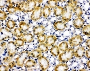 IHC staining of frozen rat kidney tissue with Paxillin antibody.