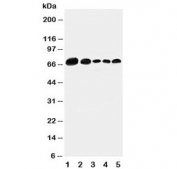 Western blot testing of human 1) 293T;  2) HeLa;  3) MCF-7;  4) MM231;  5) Jurkat cell lysate. Predicted molecular weight: 61/65/66 kDa (alpha/beta/gamma).
