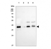 Western blot testing of human 1) 293T, 2) PC-3, 3) K562 and 4) HepG2 cell lysate with Arg2 antibody.  Expected molecular weight ~38 kDa.