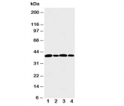 Western blot testing of Aurora B antibody and Lane 1:  rat liver; and human samples 2: 22RV;  3: HeLa;  4: SW620 cell lysate.  Predicted molecular weight: 39-45 kDa