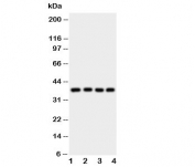 Western blot testing of Bmi1 antibody and Lane 1:  HeLa;  2: HT1080;  3: COLO320;  4: MCF-7 cell lysate. Predicted molecular weight: 37-43 kDa.