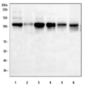 Western blot testing of 1) human HeLa, 2) human Ramos, 3) human MCF7, 4) human Jurkat, 5) rat testis and mouse testis tissue lysate with Daxx antibody. Predicted molecular weight ~81 kDa but routinely observed at ~120 kDa, the slow SDS-PAGE migration possibly due to the proteins high acidic residue content.