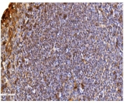 IHC staining of FFPE human tonsil with Daxx antibody. HIER: boil tissue sections in pH8 EDTA for 20 min and allow to cool before testing.