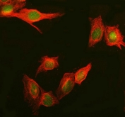 IHC staining of FFPE human tonsil with Daxx antibody. HIER: boil tissue sections in pH8 EDTA for 20 min and allow to cool before testing.