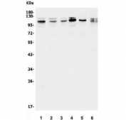 Western blot testing of human 1) Caco-2, 2) HepG2, 3) A549, 4) Raji, 5) rat testis and 6) mouse testis lysate with Daxx antibody. Predicted molecular weight ~81 kDa but routinely observed at ~120 kDa, the slow SDS-PAGE migration possibly due to the proteins high acidic residue content.
