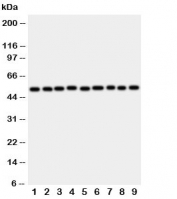 Western blot testing of E2F2 antibody and rat samples 1: lung;  2: heart;  3: brain;  4: kidney; and human samples 5: HeLa;  6: COLO320;  7: A549;  8: MCF-7;  9: SMMC-7721 cell lysate.  Predicted molecular weigh: 47-52 kDa.