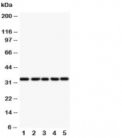 Western blot testing of E2F6 antibody and Lane 1:  HeLa;  2: COLO320;  3: A549;  4: MCF-7;  5: SMMC-7721 cell lysate. Predicted molecular weight: ~32kDa.