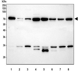 Western blot testing of HSP70 antibody and Lane 1: 293T; 2: HeLa; 3: A549; 4: A431; 5: PANC cell lysate